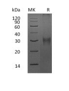 Recombinant Mouse Asprosin (N-8His)