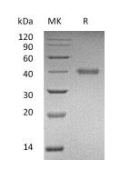 Recombinant Human RSPO1 (C-6His)