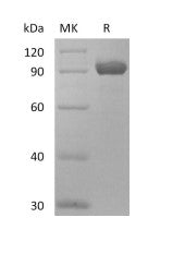 Recombinant Human NPR3 (C-Fc)