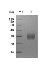 Recombinant Human Asprosin (N-8His)