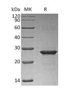 Recombinant Human OSM (N-6His)