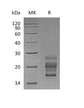 Recombinant Mouse IL-17A (C-6His)