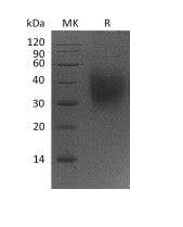 Recombinant Mouse CD47 (C-6His)
