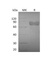 Recombinant Mouse GHR (C-Fc)