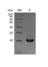 Recombinant Mouse TFF2 (C-6His)
