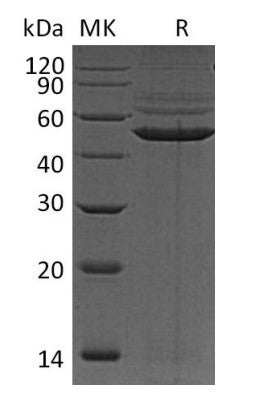 Recombinant Human PRKAR1A (C-6His)