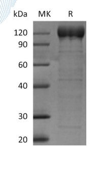 Recombinant Human AOC3 (C-Fc)