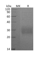Recombinant Mouse CD74 (C-6His)