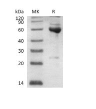 Recombinant Human Serpin B6 (N-Trx-6His)