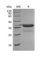 Recombinant Mouse IGFBP-7 (C-6His)