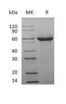 Recombinant Human Tau-F