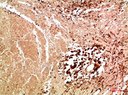 JNK3 Rabbit Polyclonal Antibody (F183)