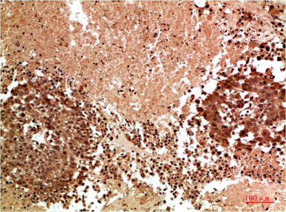JNK3 Rabbit Polyclonal Antibody (F183)