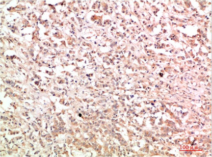 c-Abl Rabbit Polyclonal Antibody (F314）