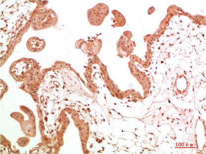 c-Abl Rabbit Polyclonal Antibody (F314）