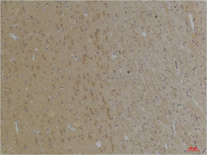 KCNK4 (TRAAK) Rabbit Polyclonal Antibody (A238)