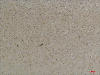 KCNK4 (TRAAK) Rabbit Polyclonal Antibody (A238)