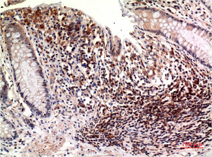 Epsilon Tubulin Mouse Monoclonal Antibody (3C1)