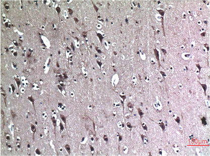 Beclin-1 Mouse Monoclonal Antibody (5C5)