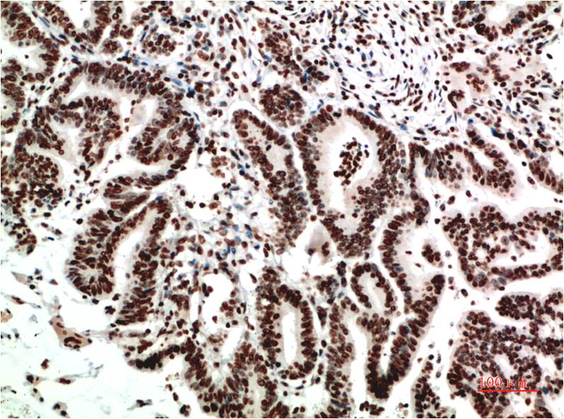 COX 2 Cyclooxygenase 2 Mouse Monoclonal Antibody (2G1)