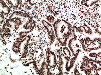 COX 2 Cyclooxygenase 2 Mouse Monoclonal Antibody (2G1)