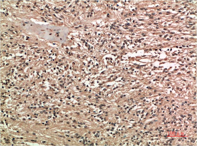 COX 2 Cyclooxygenase 2 Mouse Monoclonal Antibody (2G1)