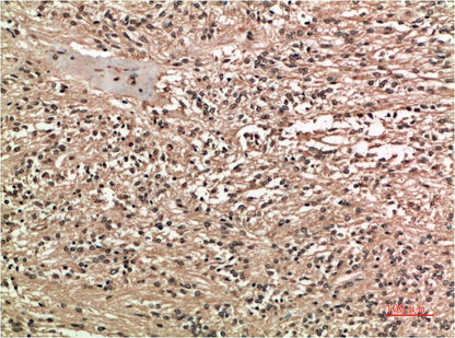 COX 2 Cyclooxygenase 2 Mouse Monoclonal Antibody (2G1)