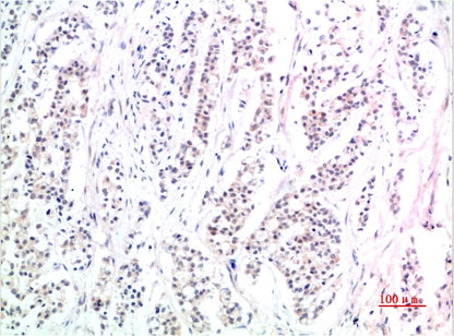 Phospho-Smad3 (S425) Mouse Monoclonal Antibody (1D9)