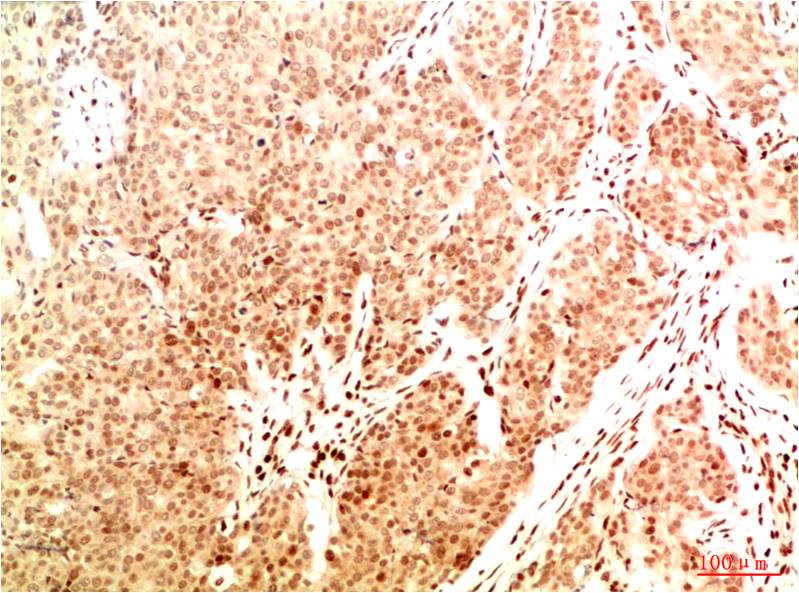 Acetyl NF kB P65 (K314 K315) Mouse Monoclonal Antibody (2A11)