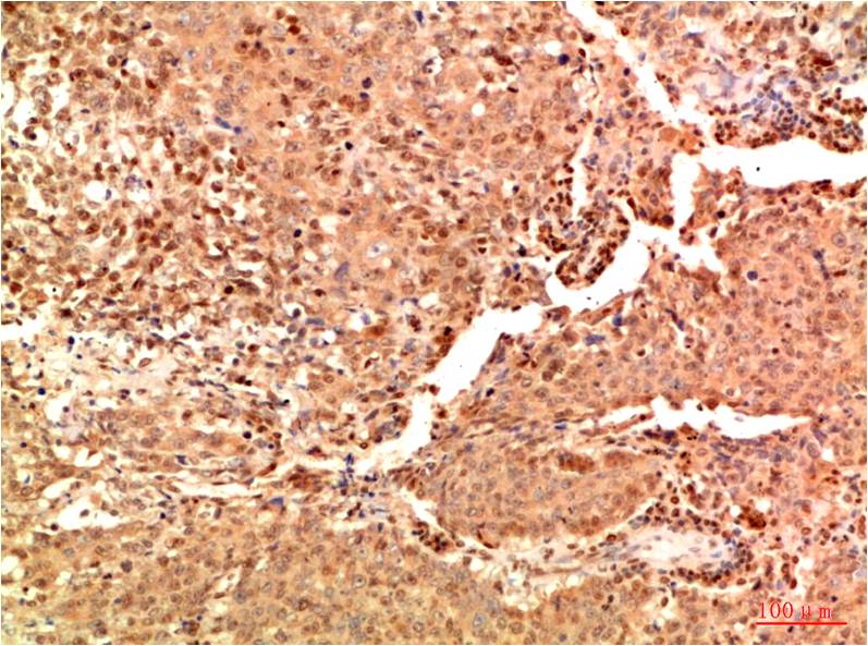 Acetyl NF kB P65 (K314 K315) Mouse Monoclonal Antibody (2A11)