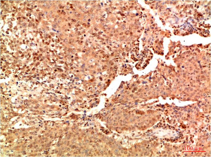 Acetyl NF kB P65 (K314 K315) Mouse Monoclonal Antibody (2A11)
