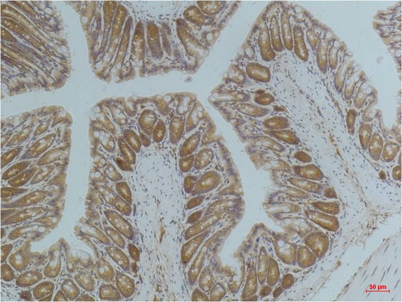 AMPK Alpha1 Mouse Monoclonal Antibody (5G11)