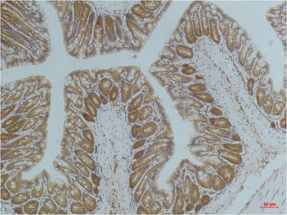 AMPK Alpha1 Mouse Monoclonal Antibody (5G11)