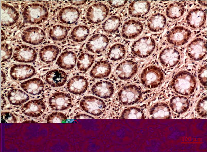 Gamma Tubulin Mouse Monoclonal Antibody (6C12)