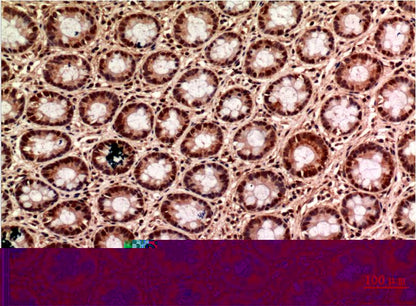 Gamma Tubulin Mouse Monoclonal Antibody (6C12)