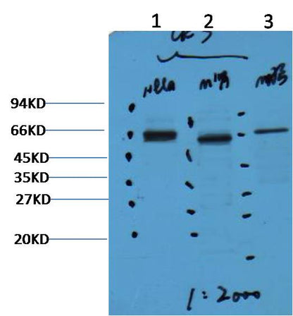 CK7 Mouse Monoclonal Antibody (12D7)