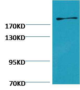 Fibronectin Mouse Monoclonal Antibody (M9)