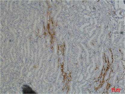 Fibronectin Mouse Monoclonal Antibody (M9)