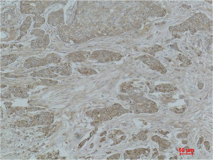 Histone H2A (Acetyl Lys15) Rabbit Polyclonal Antibody