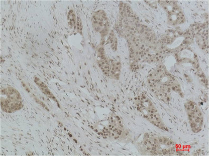 Histone H1 (Tri Methyl Lys25) Rabbit Polyclonal Antibody