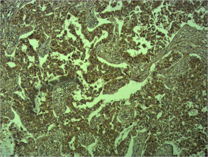 E-Cadherin Rabbit Polyclonal Antibody