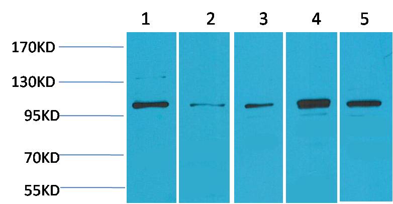ERK5 Rabbit Polyclonal Antibody (F140)