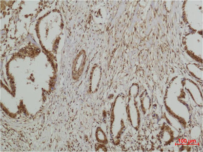 ERK5 Rabbit Polyclonal Antibody (F140)