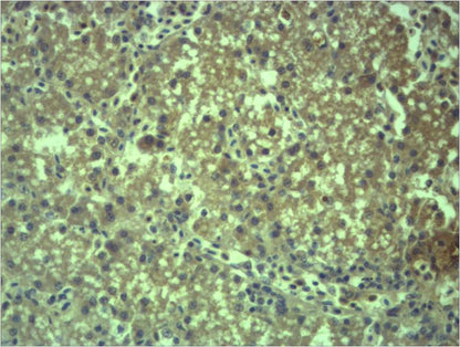 EPG5 Rabbit Polyclonal Antibody (121-240)