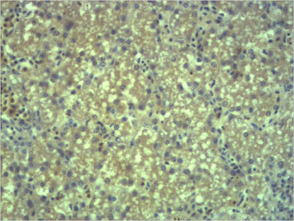 EPG5 Rabbit Polyclonal Antibody (241-331)