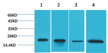 SOD1 Rabbit Polyclonal Antibody (F237)
