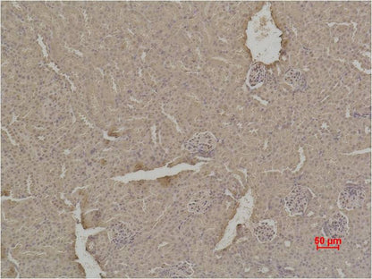 SOD1 Rabbit Polyclonal Antibody (F237)