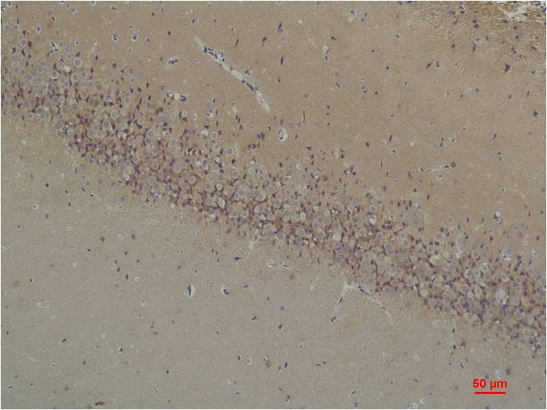 BAI1 Rabbit Polyclonal Antibody (A181)