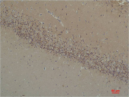 BAI1 Rabbit Polyclonal Antibody (A181)