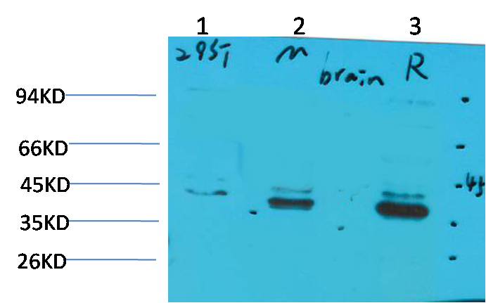 CABP2 Rabbit Polyclonal Antibody (A190)